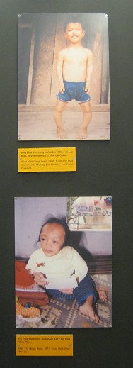 Zwei
                              Agent-Orange-Opfer