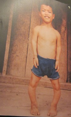 Agent-Orange-Opfer
                              Mao Van Long: Mao Van Long, geboren 1986,
                              aus der Gemeinde Lay Nua, Distrikt Muon
                              Lai, Provinz Lai Chau.