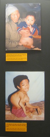 Zwei
                              Agent-Orange-Opfer