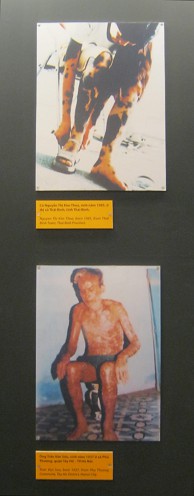 Zwei
                              Agent-Orange-Opfer