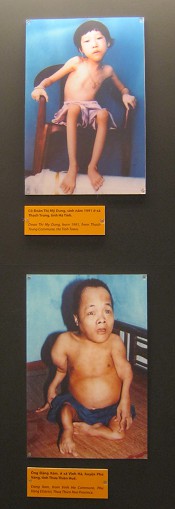 Zwei
                              Agent-Orange-Opfer