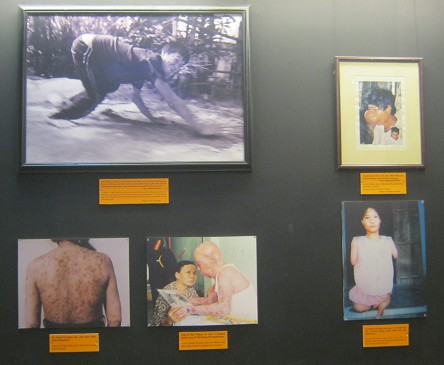 Fotowand
                                    mit Agent-Orange-Opfern