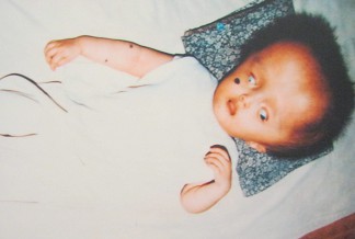 Agent-Orange-Opfer Le Thi Hoang Yen:
                              Le Thi Hoang Yen, geboren 1996, aus der
                              Gemeinde Trung Hieu, Distrikt Vung Liem,
                              Provinz Vinh Long [verformtes Gesicht,
                              verdrehte Augen, viel zu kleine Nase und
                              zu kleiner Mund]