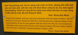 Agent-Orange-Opfer Tung, Text: Tung
                              kann nicht sprechen, ist stumm, und kann
                              nur durch die Hilfe anderer essen und
                              trinken. Aber seine Augen zeigen einen
                              Eifer, dass dass er immer noch klug und
                              verst�ndnisvoll ist. Es war
                              aussergew�hnlich zu sehen, wie seine Augen
                              von dem Durst nach dem Leben eines
                              normalen Menschen leuchteten. Ich hatte
                              das Gef�hl, dass aus dem, was in seinen
                              Augen zu sehen war, wichtige Lektionen
                              �ber das Leben zu lernen waren.
                              Tragischerweise starb Tung im August 2004.
                              Foto: Do�n D�c Minh