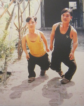 Zwei Agent-Orange-Opfer, die Br�der
                              Nguyen Ngoc Diep und Nguyen Thanh Tung:
                              Die Br�der Nguyen Ngoc Diep und Nguyen
                              Thanh Tung aus der Gemeinde Kim Long,
                              Distrikt Tam Duong, Provinz Vinh Phuc
                              [beide Br�der sind durch verformte und
                              viel zu kurze Beine etwas gehbehindert]