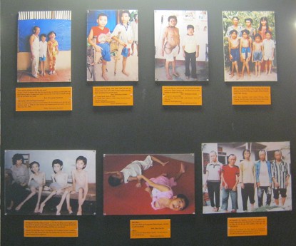 Fotogalerie mit
                                    Agent-Orange-Opfern, Nahaufnahme