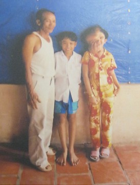 Vater mit
                              Agent-Orange-Opfer: "Mein Vater wurde
                              mit Agent Orange verseucht" Ein
                              M�dchen, 17 Jahre alt, ist durch ihren
                              Vater von Agent Orange betroffen. Sie ist
                              blind, ist auf dem linken Ohr taub und
                              kann kaum laufen. Ihr Vater kann ihre
                              Stimme verstehen (Saigon / Ho Chi
                              Minh-Stadt, Februar 2006) Foto: Murayama
                              Yasufumi