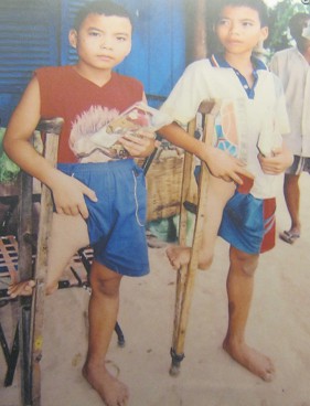 Zwei Agent-Orange-Opfer: Le
                              Thanh Minh und Le Thanh Tuan: Le Thanh
                              Minh (geboren 1992) und Le Thanh Tuan
                              (geboren 1996). Distrikt Chau Thanh,
                              Provinz Tay Ninh. Krankheit:
                              Oberschenkeldefekt am rechten Oberschenkel
                              Foto: Nishimura Yoichi