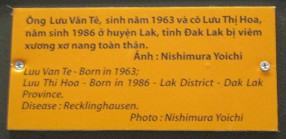 Agent-Orange-Opfer Luu Van Te und Luu
                              Thi Hoa, Text: Agent-Orange-Opfer Luu Van
                              Te (geboren 1963) und Luu Thi Hoa (geboren
                              1986), Distrikt Lak, Provinz Lak.
                              Krankheit: Recklinghausen
                              [Von-Recklinghausen-Krankheit: ist eine
                              Neurofibromatose, eine
                              Multiorganerkrankung, betroffen sind vor
                              allem die Haut und das Nervensystem -
                              web01] Foto: Nishimura Yoichi