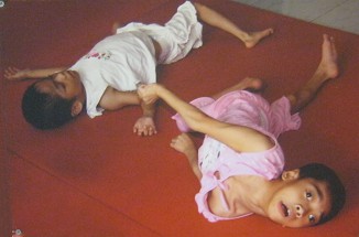 Zwei
                              Agent-Orange-Opfer im Zentrum "Thien
                              Phuoc": Schmerzen Die Opfer im
                              Zentrum "Thien Phuoc" - Distrikt
                              Cu Chi - Saigon (Ho Chi Minh-Stadt)
                              [These: Die beiden Opfer k�nnen nur am
                              Boden liegen und rufen vor Schmerzen
                              dauernd herum]