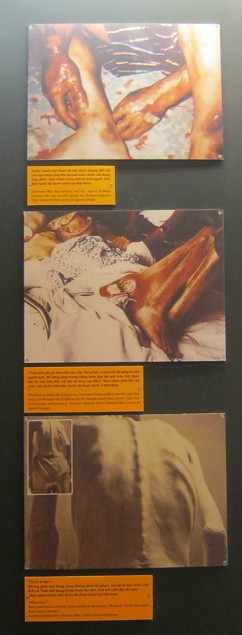 3 Fotos mit Agent-Orange-Opfern