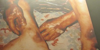 Agent-Orange-Opfer, ein koreanischer
                              Veteran: Der Vietnamkrieg ging zu Ende,
                              aber f�r die Agent-Orange-Opfer ist dieser
                              Krieg nie zu Ende. Hier ein koreanischer
                              Veteran aus dem Vietnamkrieg, auch ein
                              Agent-Orange-Opfer