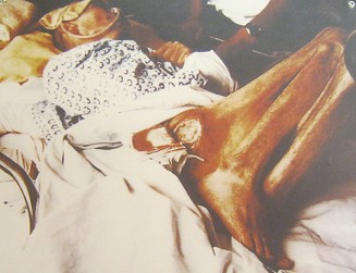 Agent-Orange-Opfer, ein koreanischer
                              Veteran: Der ausgetrocknete K�rper wurde
                              zur Mumie... ich wundere mich, ob ich
                              wirklich mal ein Krieger war, der unter
                              Feuerbeschuss an den Frontlinien durch den
                              Dschungel rannte, als ich noch kr�ftig und
                              mutig war. Koreanischer Veteran aus dem
                              Vietnamkrieg, Agent-Orange-Opfer