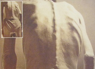 Agent-Orange-Opfer, ein
                                  Korea-Veteran: "Was bin ich? Kein
                                  Held, nur ein Krimineller, aber ein
                                  Opfer der Geschichte. Der K�rper ist
                                  schwer durch Agent Orange
                                  gesch�digt." Koreanischer Veteran
                                  vom Vietnamkrieg, Agent-Orange-Opfer