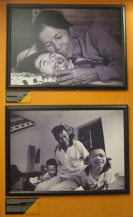 Zwei Fotos mit Agent-Orange-Opfern