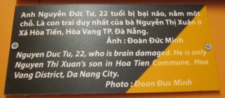Agent-Orange-Opfer,
                              Text: Nguyen Duc Tu, 22, hat einen
                              Hirnschaden. Er ist der Sohn von Nguyen
                              Thi Xuan aus der Gemeinde Hoa Tien,
                              Stadtbezirk Hoa Vang, Stadt Da Nang.