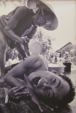 Agent-Orange-Opfer Nguyen
                              Thi Chot: Nguyen Thi Chot ist 62 und die
                              Mutter von zwei Kindern. Hir Ehemann,
                              Nguyen Sat, war w�hrend dem alten Regime
                              ein Soldat, stationiert im Dorf Cam Hoa,
                              Stadt Hoi An. Eines der Kinder ist der 38
                              Jahre alte Nguyen Vinh. Seine schweren
                              Gesundheitsprobleme begannen mit 2 Jahren,
                              als seine Arme und Beine zu schrumpfen
                              begannen. Tagt�glich findet das Leben von
                              Vinh nur im Bett statt. Die einzige
                              Abwechslung kommt alle drei Tage, wenn ihn
                              seine Mutter ins Bad tr�gt, um ihn zu
                              waschen.