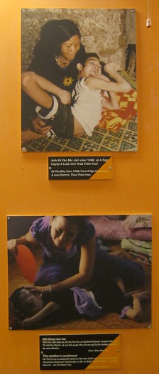 Zwei
                              Agent-Orange-Opfer