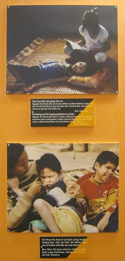 Zwei
                              Agent-Orange-Opfer