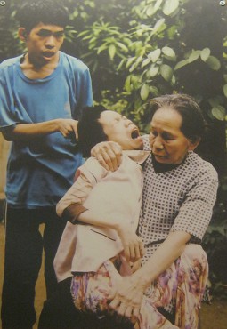 Agent-Orange-Opfer,
                              das Kind von Mutter Nguyen Thi Huyen: Frau
                              Nguyen Thi Huyen mit ihrem Kind, Gemeinde
                              Cam Lo, Distrikt Cam Lo, Provinz Quang Tri
                              [Dauerschmerzen]