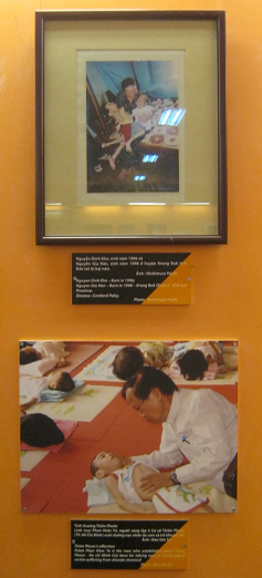 Zwei Agent-Orange-Opfer