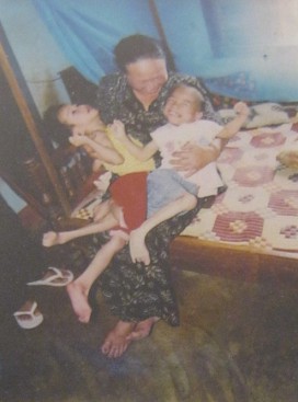 Zwei Agent-Orange-Opfer,
                                  Nguyen Dinh Kha (*1996) und Nguyen Gia
                                  Han (*1998): Nguyen Dinh Kha, geboren
                                  1996, und Nguyen Gia Han, geboren 1998
                                  - Distrikt Krong Buk, Provinz Dak
                                  Lak.