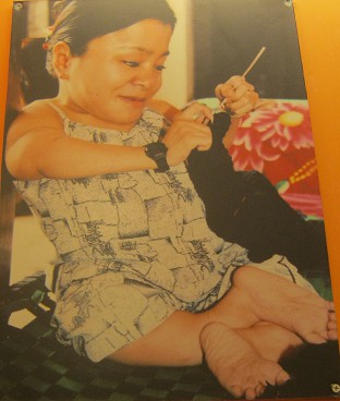 Agent-Orange-Opfer Pham Thi Vuong:
                              Pham Thi Vuong, geboren 1978, aus der
                              Gemeinde Binh Trung, Distrikt Binh Son,
                              Provinz Quang Ngai. Im Alter von 27 ist
                              Vuong nur 80cm gross und wiegt 12kg. Sie
                              wurde mit einer Halbl�hmung geboren, aber
                              sie versucht, eine akademische Bildung zu
                              erreichen, macht Kunsthandwerk und
                              verkauft Sachen. Sie hat Einnahmen, um
                              ihre Familie zu unterst�tzen.