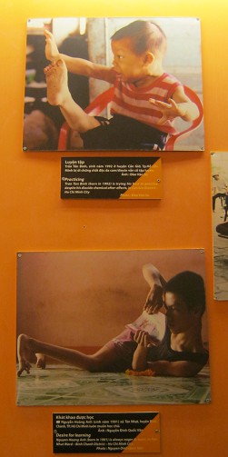 Zwei
                              Agent-Orange-Opfer