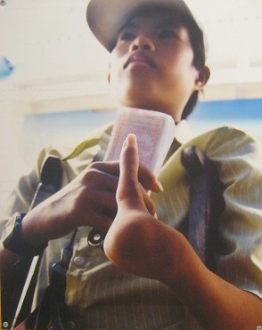 Agent-Orange-Opfer, Hand mit nur
                              einem Finger: Die Hand dieses Jungen hat
                              nur einen Finger (August 2005, Ben Tre
                              Ministry) Foto: Murayama Yasufumi