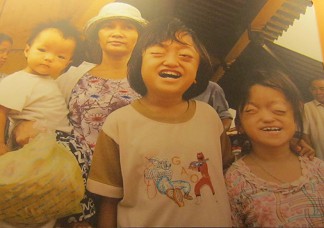 2
                              Agent-Orange-Opfer: Mutter und Kinder
                              Diese Familie bestreitet ihren
                              Lebensunterhalt, indem sie Produkte
                              verkaufen und Lotterielose im Chinatown in
                              Saigon (Ho Chi Minh City) verkaufen. Beide
                              �ltern Kinder sind Opfer der
                              Agent-Orange-Chemikalien. Die beiden
                              Kinder haben klassische Symptome,
                              verursacht durch Agent Orange
                              [hervorstehende Augen, das Gehirn scheint
                              reduziert und die Sinne eingeschr�nkt]
                              Foto: Muroyama Yasafumi