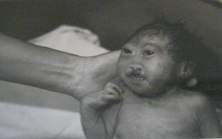 Agent-Orange-Opfer mit reduziertem
                              Hirn: Dieses Baby wurde deformiert mit
                              einem kleinen Hirn geboren, mit einer
                              Mundspalte, mit defekten Ohren und
                              Gliedern. Es starb einen Tag sp�ter.