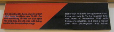 Agent-Orange-Opfer, Text:
                              Namenloses Baby, es wurde aus der Provinz
                              Vinh Long ins Tu-Du-Spital [in Saigon / Ho
                              Chi Minh City] gebracht. Sie wurde im
                              November 1998 mit Hydro-Enzephalitis
                              geboren und starb einen Monat nach diesem
                              Foto.