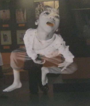 Agent-Orange-Opfer in der
                              Physiotherapie im Friedensdorf von Hanoi