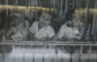 3 Agent-Orange-Opfer mit doppelten
                              Armen und Knien: Drei Geschwister zeigen
                              teratogenische Symptome mit doppelten
                              Ellenbogen und doppelten Knien an allen
                              ihren Gliedern. Waisenhaus Nr. 6, 1980