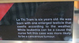 Agent-Orange-Opfer Le
                              Thi Tram, Text: Le Thi Tram ist 6 Jahre
                              alt. Er wurde mit einem vergr[osserten
                              Hoden geboren, der je nach Wetter
                              anschwillt. Leuk[amie kann daf[ur die
                              Ursache sein, aber die Krankenschwester
                              meinte, dass dieser Fall eher was mit
                              einem Krebstumor zu tun hat.