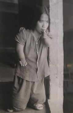 Agent-Orange-Opfer Le Thi
                                          Hoa (14), verk�mmert und
                                          deformierte Finger