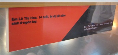 Agent-Orange-Opfer Le Thi Hoa,
                                  Text: Agent-Orange-Opfer Le Thi Hoa
                                  (14), wurde verk�mmert geboren und hat
                                  deformierte Finger