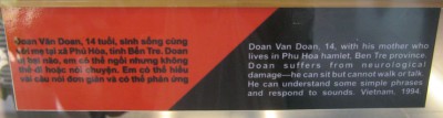 Agent-Orange-Opfer Toan Van Doan,
                              Text: Toan Van Doan (14) mit seiner
                              Mutter, die im Weiler Phu Hoa lebt,
                              Provinz Ben Tre. Doan leidet an einer
                              Nervenkrankheit - er kann sitzen aber kann
                              nicht laufen oder sprechen. Er kann einige
                              einfache S�tze verstehen und auf Kl�nge
                              antworten. Vietnam 1994