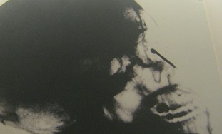 Vietnamkrieg: Ein Opfer einer
                              "schwarzen Rakete"