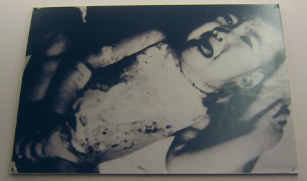 Baby-Napalmopfer
                              Nguyen Hong Tam, 2 Jahre alt, 15. Oktober
                              1965: Die 2 Jahre alte Nguyen Hong Tam
                              erlitt am 15. Oktober 1965
                              Brandverletzungen durch Napalmbomben.