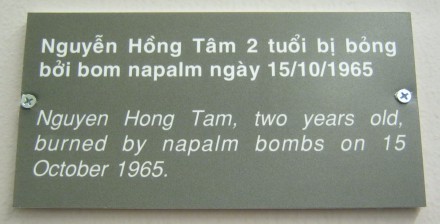 Baby-Napalmopfer Nguyen Hong Tam, 2
                            Jahre alt, 15. Oktober 1965 - Text