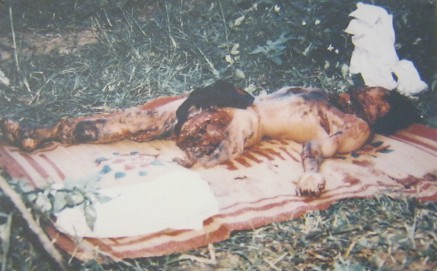 Das hist Ho Van Dang aus dem Weiler
                                Khe Song, Dorf Huong Hiep, Distrikt Da
                                Kong, Provinz Quang Tri [zentrales
                                Vietnam], wurde am 6. November 2003
                                Opfer einer nicht explodierten
                                "US"-Mine.